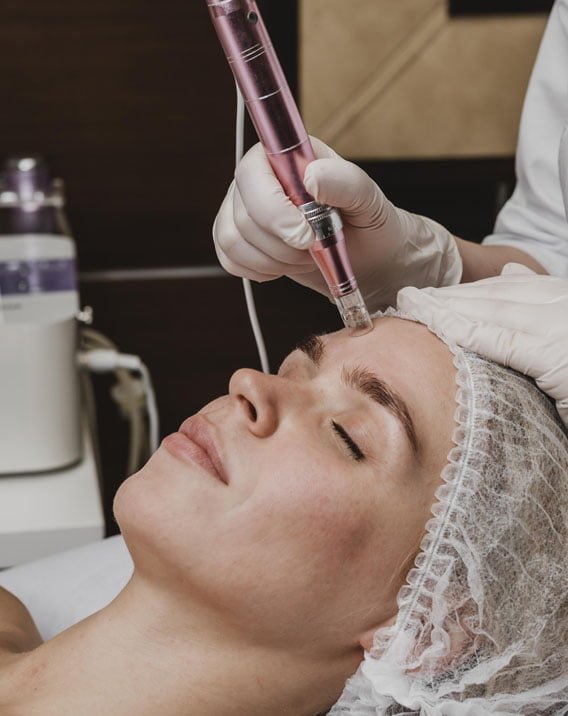 MICRONEEDLING